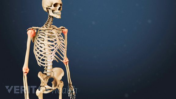 joint pain