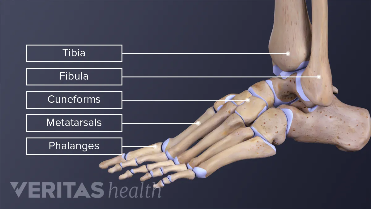 What Is Ankle Arthritis? - MyAnkle