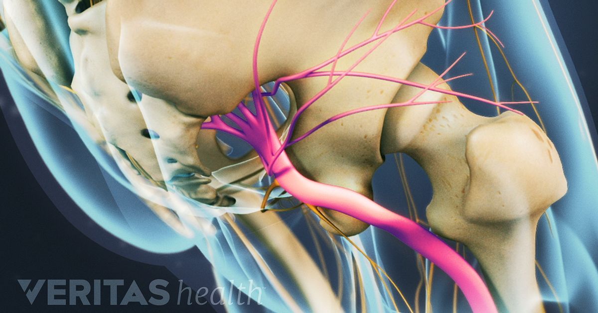 Nervio de ciático dolor para analgésico