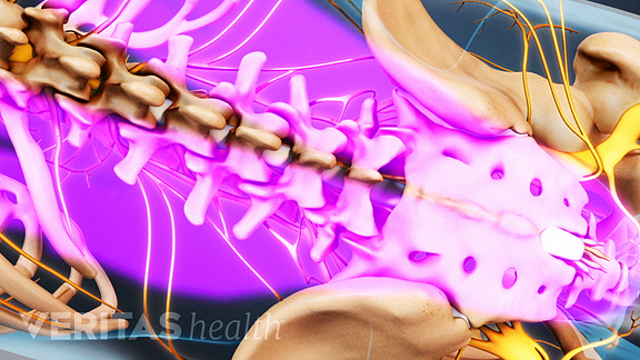 moving erector spinae