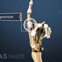 Profile of the hand labeling the synovium in the finger joint.