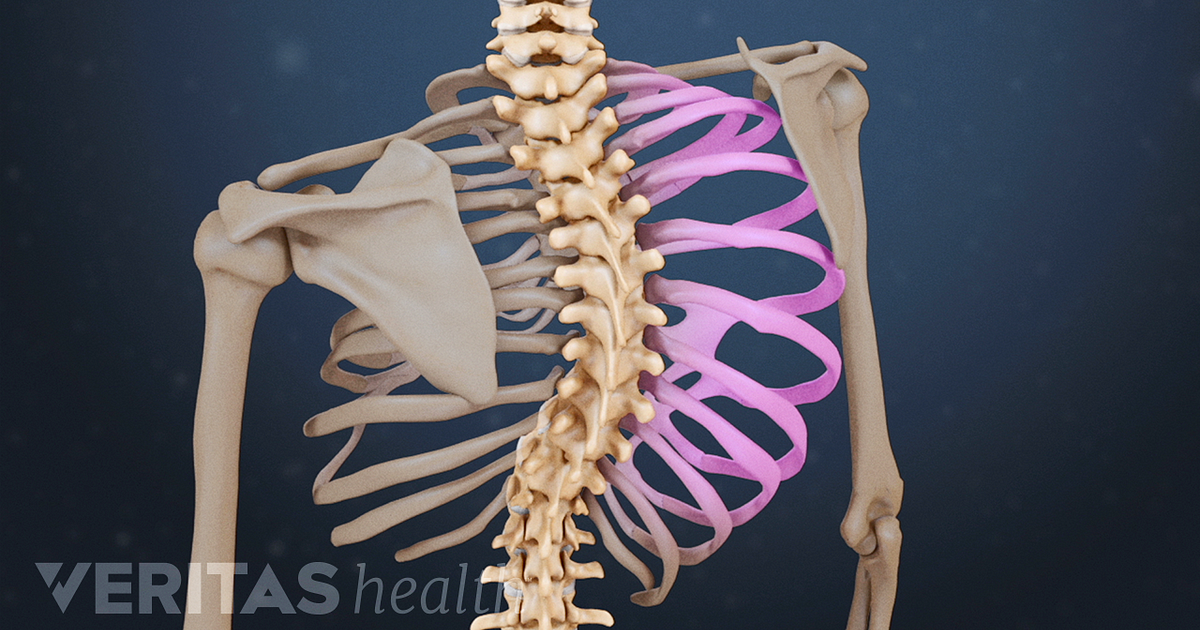 Types Of Scoliosis Types Of Scoliosis