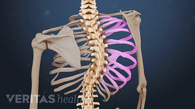 juvenile rheumatoid arthritis and scoliosis)