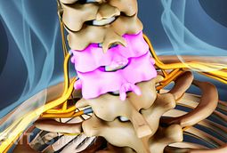 All about the C6-C7 Spinal Segment in the Neck