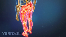 Posterior view of the legs with pain in both legs.