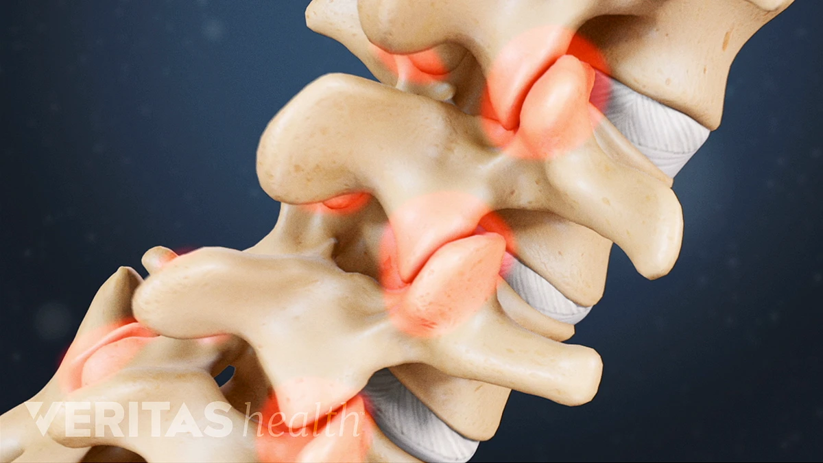 Symptoms & Diagnosis of Lower Back Pain