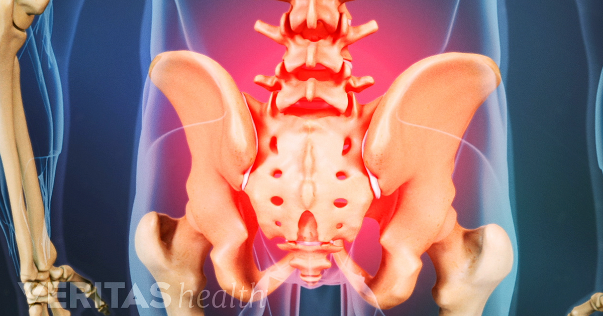 sacroiliacalis osteoarthritis erős fájdalom a térd alatt hajlításkor