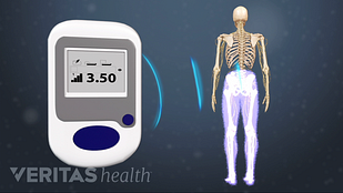 Image of spinal cord remote sending signals to spinal cord stimulator in the lower back