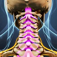 Foraminal Stenosis Definition | Back Pain and Neck Pain Medical Glossary