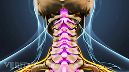 Cervicogenic Headache Symptoms Cervicogenic Headache Symptoms