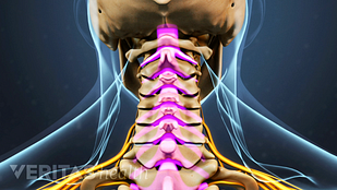 cervical-spinal-stenosis.png”loading=