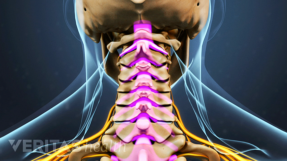 Posterior view of the neck and skull highlighting pain going down the vertebra of the cervical spine.
