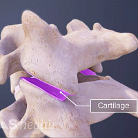 Two vertebrae with cartilage highlighted in between them.