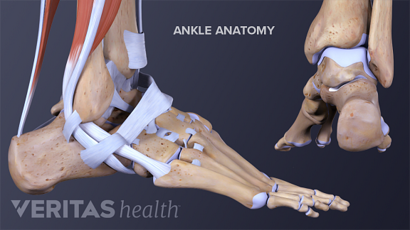 All About Ankle Sprains and Strains