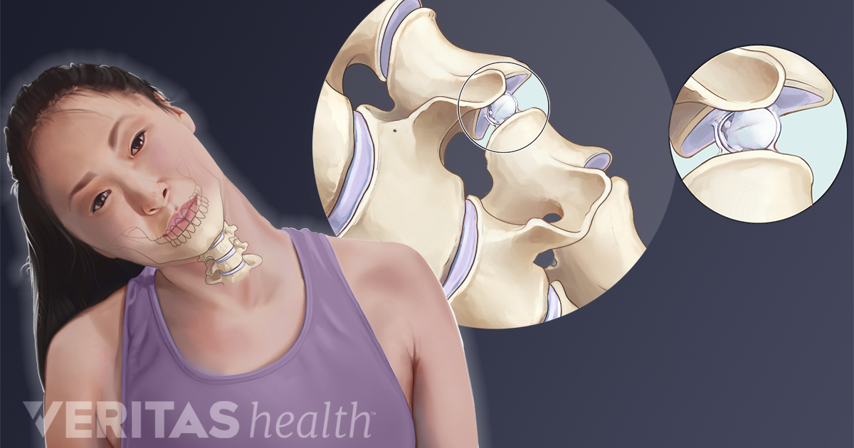 Tratament articular crepitus Va trosnesc genunchii? Atentie la riscul de artrita!