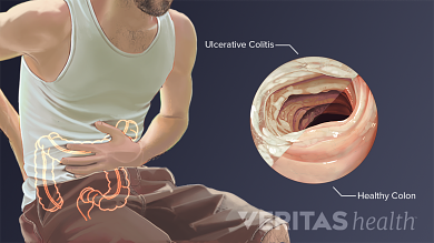 In side back right pain lower Lower Right