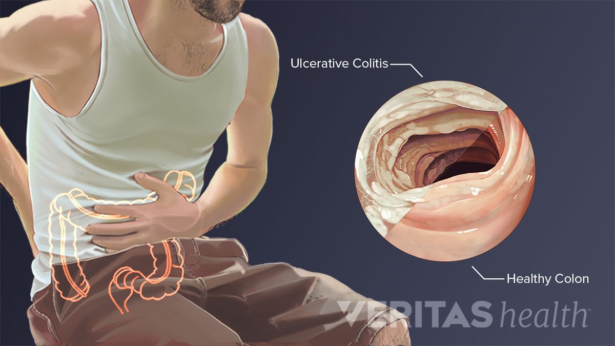 Lower Left Back Pain from Internal Organs