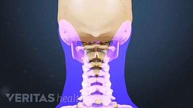 complex pentru osteocondroza coloanei vertebrale