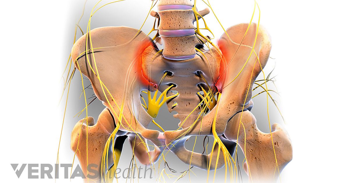 health form s1 and Causes Sacroiliitis Joint SI Possible Pain of