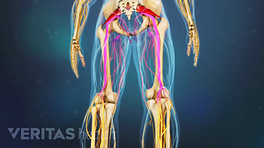 Medical illustration of the lower body. The sciatic nerves are highlighted in red to indicate pain, numbness or tingling.