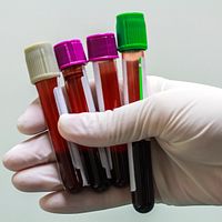 Hand holding four vials of blood.