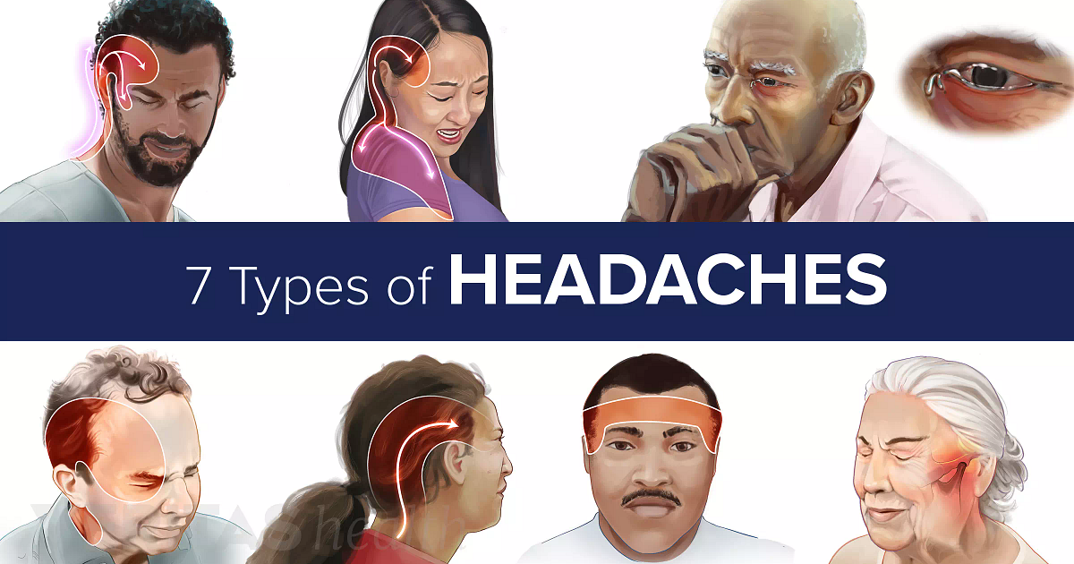 Slideshow 7 Types Of Headaches