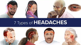 Cervicogenic Headache Symptoms