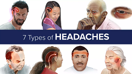 Cervicogenic Headache Symptoms Cervicogenic Headache Symptoms