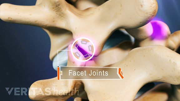 Medial Branch Nerve Block Facet Joint
