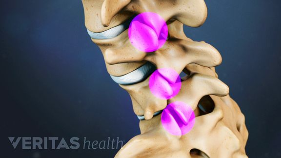 The vertebrae of the lumbar spine are connected by facet joints.