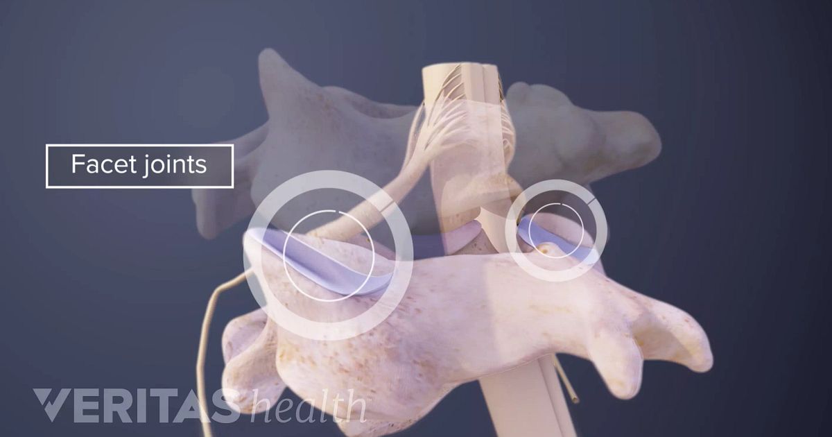 Apophyseal Joint Definition | Back Pain and Neck Pain Medical Glossary