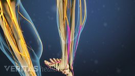 Sciatica Surgery