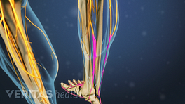 Medical illustration of the lower legs showing bone and nerve structures. One nerve in the right leg is highlighted in red to indicate pain, numbness or tingling.