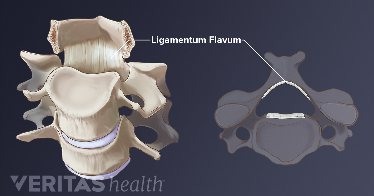 Ligamentum Flavum Definition Back Pain and Neck Pain Medical Glossary