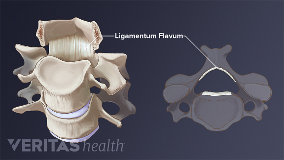 Ligamentum Flavum Definition Back Pain And Neck Pain Medical