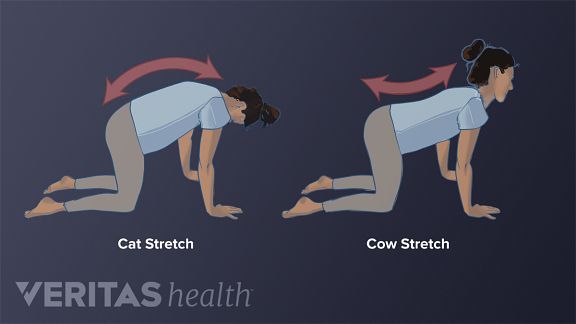 Exercise for spinal stenosis with pictures