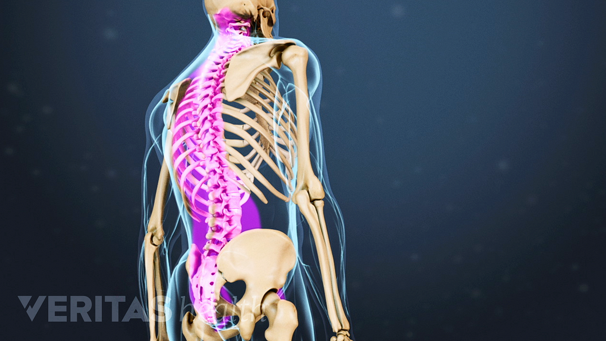 Spinal Anatomy And Back Pain