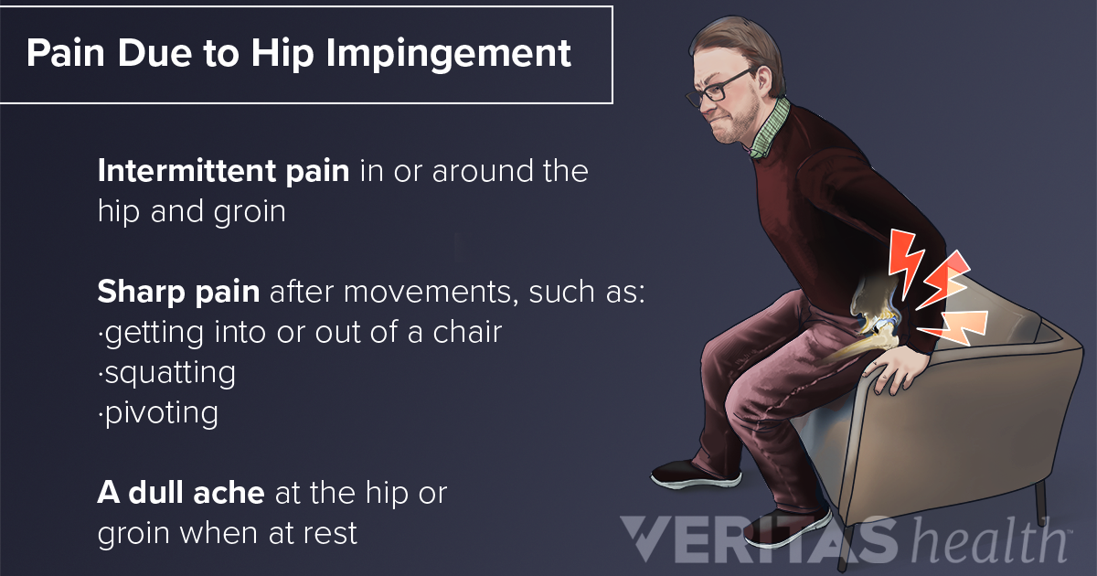 Hip Impingement Symptoms