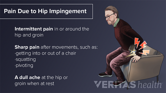 Hip Impingement Symptoms