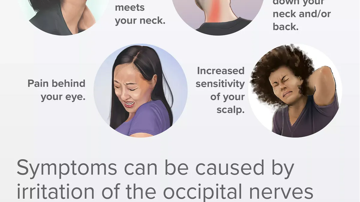 Occipital Neuralgia Overview Infographic