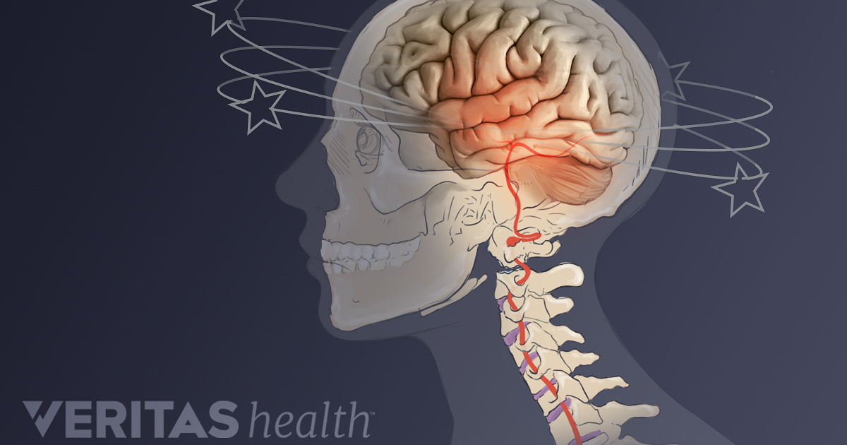 What Causes Neck Pain And Dizziness 