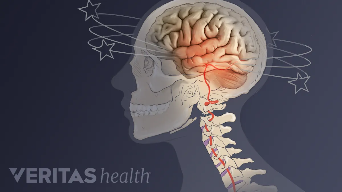 Dizziness: Know Dizziness Causes, Symptoms, Treatment & What It Is?