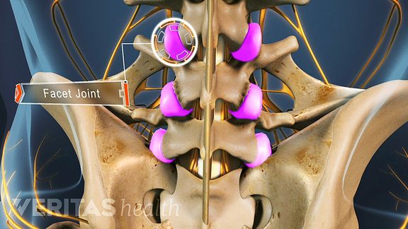 5 Unusual Ankylosing Spondylitis Symptoms