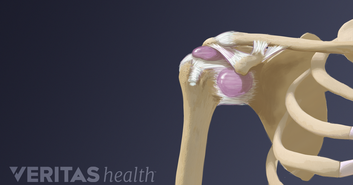 Synovial Cyst Size Chart