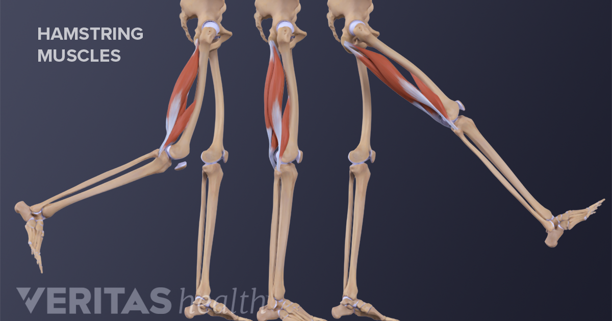 High Proximal Hamstring Tendinopathy Risk Factors 7639